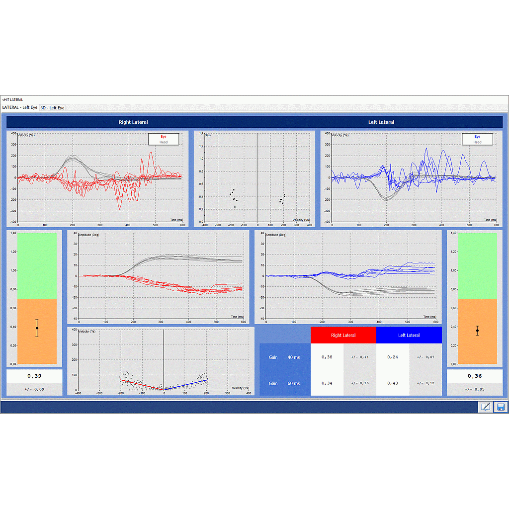DI 14050X-VHITL : Nystagmography software Disoft II PRO Line : VHIT Lateral Only