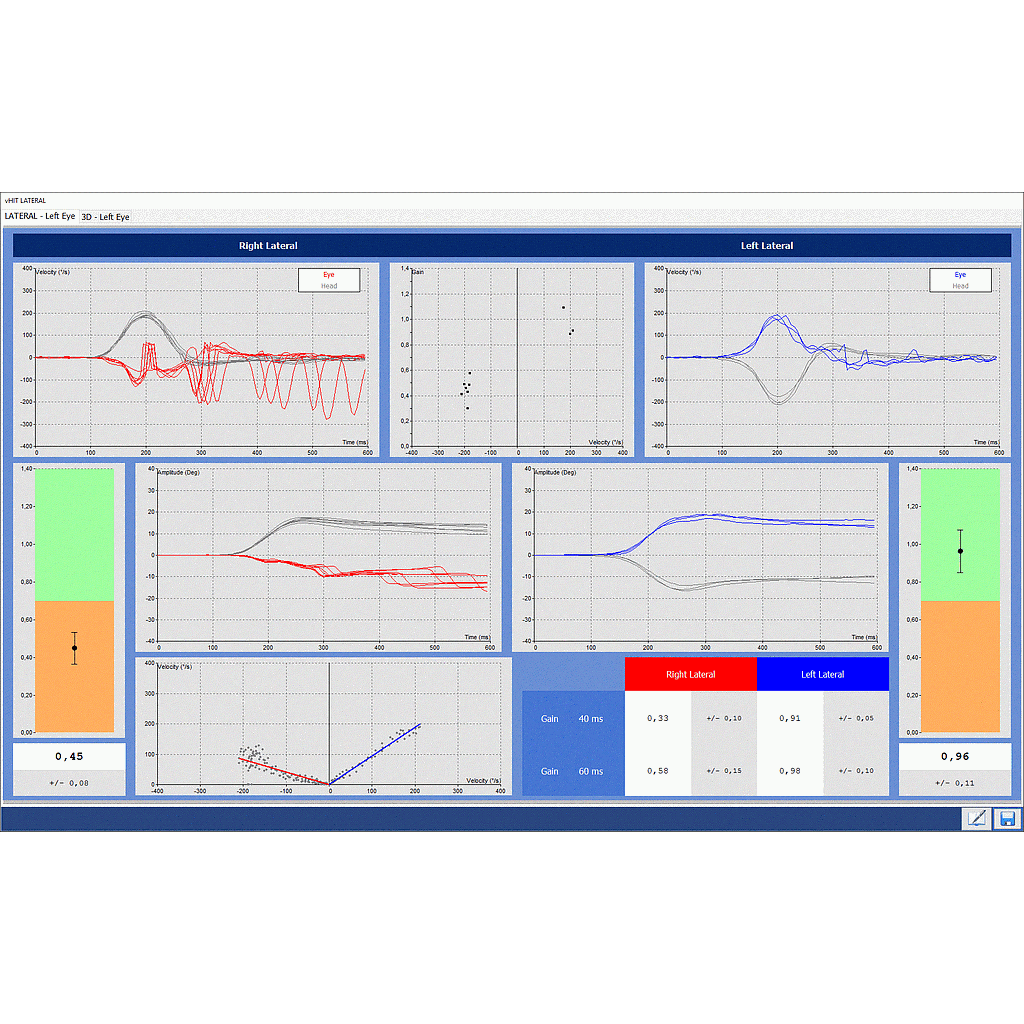 Option for Headstar Video Head Impulse Test, on 6 semi-circular channels (Lateral, LARP, RALP) at 250Hz