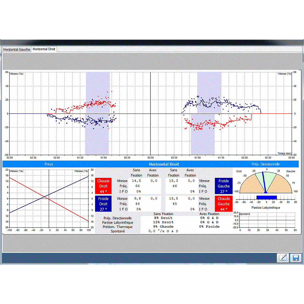 Nystagmography software Disoft II PRO Line : Basic Module