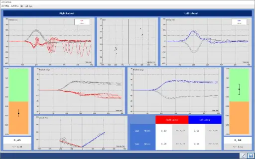 [00020678] DI 14050X-VHITL: Nystagmography software Disoft II PRO Line : VHIT Lateral Only